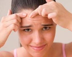 How stress affects acne?